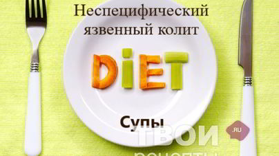 Суп-пюре из цветной капусты